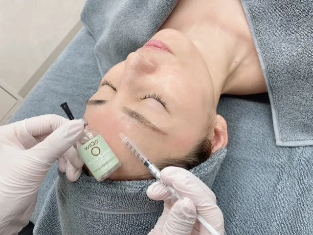 ワイコW水光ピール